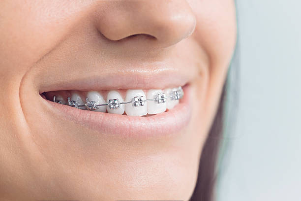 Dental Inlays and Onlays in Barbourville, KY